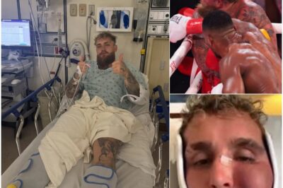 BREAKING: Shocking Images Of Jake Paul’s Swollen Face Leak Online After Anthony Joshua Broke His Jaw [PHOTOS].K