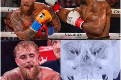 SH0CKING BOMBSHELL: Jake Paul’s Shocking One-Word Response to Letting Someone Break His Jaw for $92M Is Going Viral – Liquid Diet Hell for 7 Days Exposed [VIDEO].K