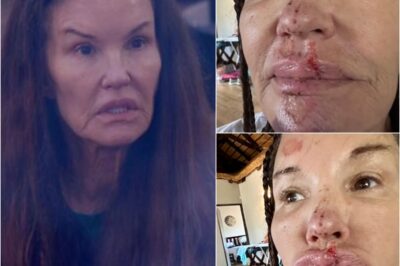 ITV Issues Urgent Statement: ITV issues statement as Janice Dickinson shares bloodied pics and claims she sustained “permanent scarring” in I’m A Celebrity fall .k