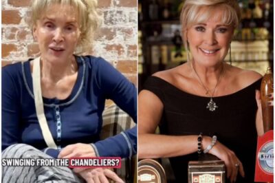 “I’m Scared of What I’ll Look Like…” Corrie Legend Beverley Callard BREAKS DOWN In Heartbreaking Post-Op Update As She Struggles To Eat