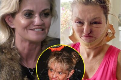 Bombshell: Unrecognisable Danniella Westbrook bloodied, bruised and swollen as she’s seen in wheelchair following surgery in Dubai.k